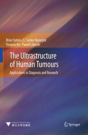 The Ultrastructure of Human Tumours: Applications in Diagnosis and Research de Brian Eyden