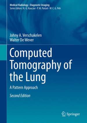 Computed Tomography of the Lung: A Pattern Approach de Johny A. Verschakelen