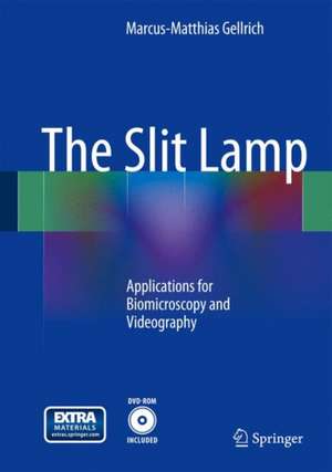 The Slit Lamp: Applications for Biomicroscopy and Videography de Marcus-Matthias Gellrich