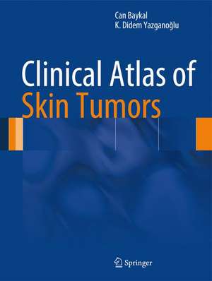 Clinical Atlas of Skin Tumors de Can Baykal