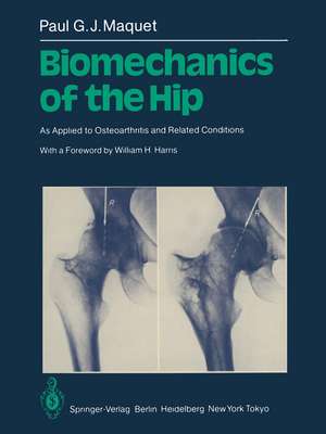 Biomechanics of the Hip: As Applied to Osteoarthritis and Related Conditions de P.G.J. Maquet