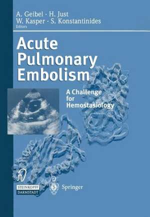 Acute Pulmonary Embolism: A Challenge for Hemostasiology de A. Geibel