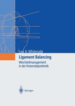 Ligament Balancing: Weichteilmanagement in der Knieendoprothetik de Leo A. Whiteside