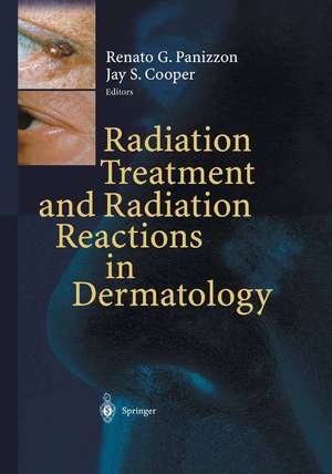 Radiation Treatment and Radiation Reactions in Dermatology de Renato G. Panizzon