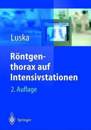 Röntgenthorax auf Intensivstationen de Günter Luska