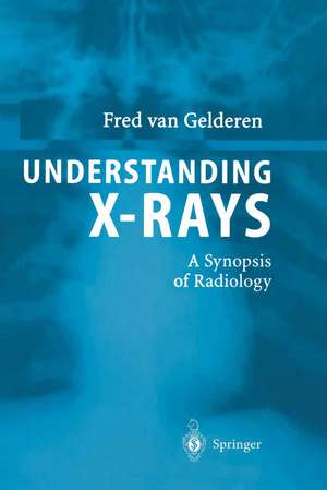 Understanding X-Rays: A Synopsis of Radiology de Fred van Gelderen