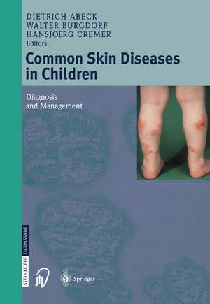 Common Skin Diseases in Children: Diagnosis and Management de Dietrich Abeck