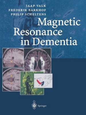 Magnetic Resonance in Dementia de Frederik Barkhof