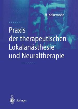 Praxis der therapeutischen Lokalanästhesie und Neuraltherapie de Heribert Kokemohr