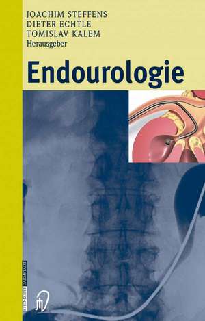 Endourologie de Joachim Steffens