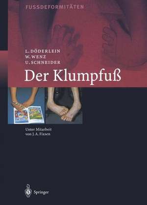 Der Klumpfuss: Erscheinungsformen und Behandlungsprinzipien jeden Alters. Differentialdiagnose und Differentialtherapie de Leonhard Döderlein