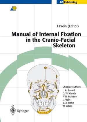 Manual of Internal Fixation in the Cranio-Facial Skeleton: Techniques Recommended by the AO/ASIF Maxillofacial Group de Joachim Prein