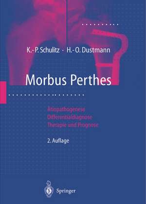 Morbus Perthes: Ätiopathogenese, Differentialdiagnose, Therapie und Prognose de Klaus-Peter Schulitz