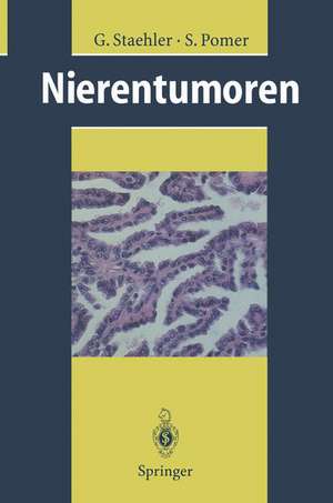 Nierentumoren: Grundlagen, Diagnostik, Therapie de G. Staehler