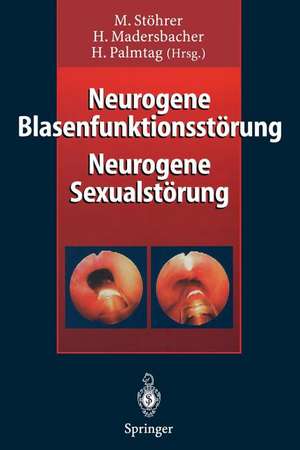 Neurogene Blasenfunktionsstörung Neurogene Sexualstörung de Manfred Stöhrer