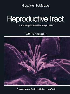 The Human Female Reproductive Tract: A Scanning Electron Microscopic Atlas de H. Ludwig