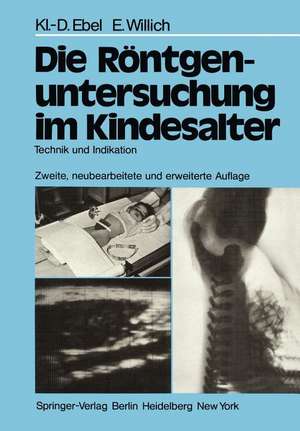 Die Röntgenuntersuchung im Kindesalter: Technik und Indikation de R.D. Schulz