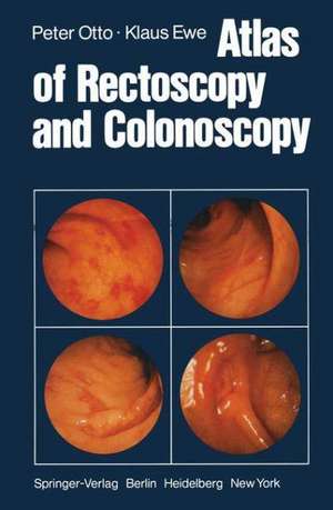 Atlas of Rectoscopy and Coloscopy de Potto