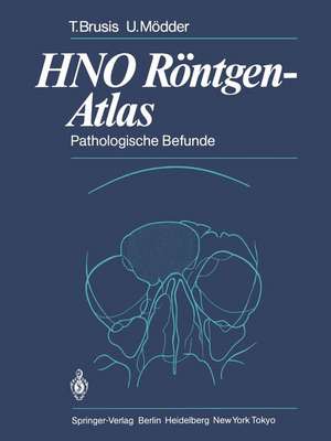 HNO Röntgen-Atlas: Pathologische Befunde de Tilman Brusis