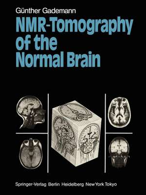 NMR-Tomography of the Normal Brain de Günther Gademann