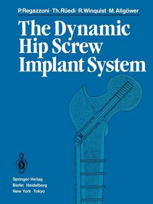 The Dynamic Hip Screw Implant System de P. Regazzoni