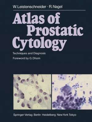 Atlas of Prostatic Cytology: Techniques and Diagnosis de W. Leistenschneider