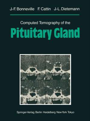 Computed Tomography of the Pituitary Gland: With a Chapter on Magnetic Resonance Imaging of the Sellar and Juxtasellar Region, By M. Mu Huo Teng and K. Sartor de M. Mu Huo Teng