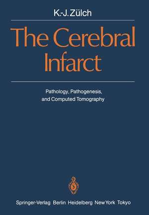 The Cerebral Infarct: Pathology, Pathogenesis, and Computed Tomography de K. -J. Zülch