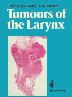 Tumours of the Larynx: Histopathology and Clinical Inferences de Erhard Meyer-Breiting