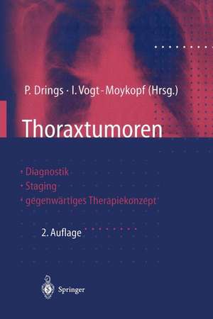 Thoraxtumoren: Diagnostik — Staging — gegenwärtiges Therapiekonzept de Peter Drings