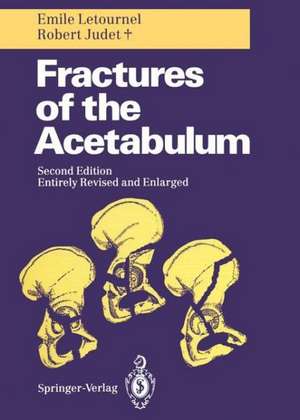 Fractures of the Acetabulum de Reginald A. Elson