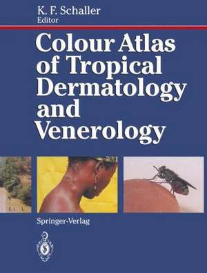 Colour Atlas of Tropical Dermatology and Venerology de F.A. Bahmer