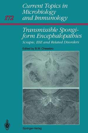 Transmissible Spongiform Encephalopathies:: Scrapie, BSE and Related Human Disorders de Bruce W. Chesebro