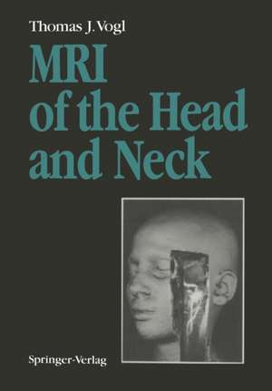 MRI of the Head and Neck: Functional Anatomy — Clinical Findings — Pathology — Imaging de Thomas J. Vogl