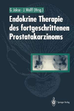 Endokrine Therapie des fortgeschrittenen Prostatakarzinoms de Gerhard Jakse