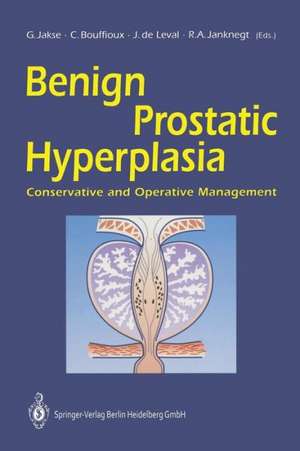 Benign Prostatic Hyperplasia: Conservative and Operative Management de Gerhard Jakse