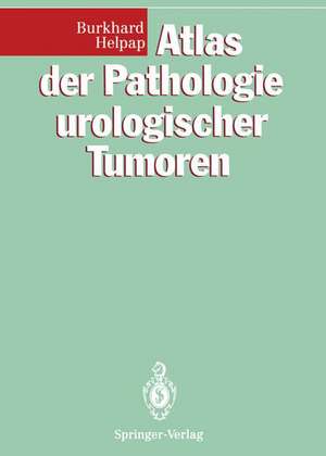 Atlas der Pathologie urologischer Tumoren de Burkhard Helpap