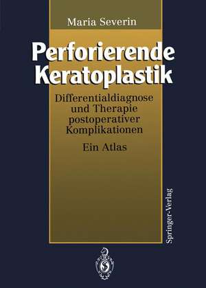 Perforierende Keratoplastik: Differentialdiagnose und Therapie postoperativer Komplikationen de Maria Severin