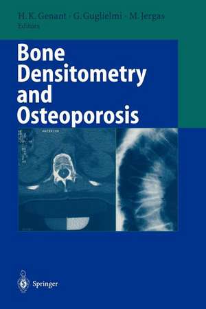 Bone Densitometry and Osteoporosis de Harry K. Genant