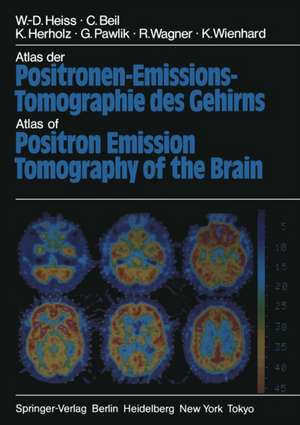 Atlas der Positronen-Emissions-Tomographie des Gehirns / Atlas of Positron Emission Tomography of the Brain de W.-D. Heiss