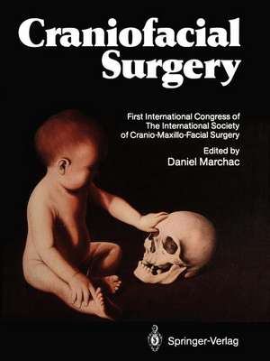 Craniofacial Surgery: Proceedings of the First International Congress of The International Society of Cranio-Maxillo-Facial Surgery. President: Paul Tessier. Cannes-La Napoule, 1985 de Daniel Marchac