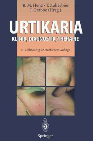 Urtikaria: Klinik, Diagnostik, Therapie de Beate M. Henz