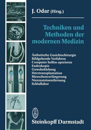 Techniken und Methoden der modernen Medizin: Ästhetische Gesichtschirurgie Bildgebende Verfahren Computer helfen operieren Endoskopie Gewebeklebung Herztransplantation Menschenverlängerung Nierensteinentfernung Schlaflabor de J. Odar