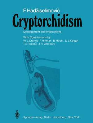 Cryptorchidism: Management and Implications de F. Hadziselimovic