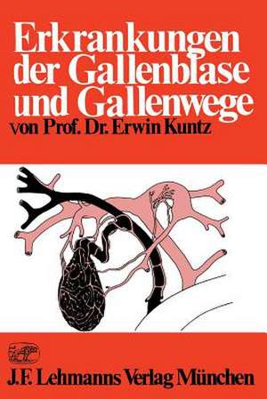 Erkrankungen der Gallenblase und Gallenwege de E. Kuntz