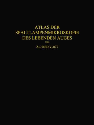 Atlas der Spaltlampenmikroskopie des Lebenden Auges: Mit Anleitung zur Technik und Methodik der Untersuchung de Alfred Vogt