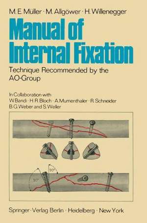 Manual of Internal Fixation: Technique Recommended by the AO-Group Swiss Association for the Study of Internal Fixation: ASIF de W. Bandi