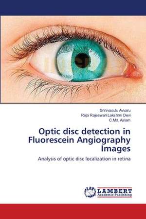 Optic disc detection in Fluorescein Angiography Images de Srinivasulu Avvaru