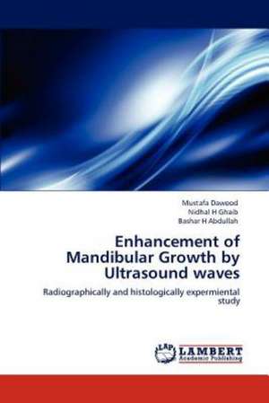 Enhancement of Mandibular Growth by Ultrasound waves de Mustafa Dawood