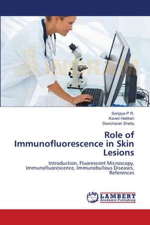 Role of Immunofluorescence in Skin Lesions de Sanjaya P.R.